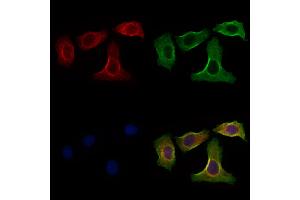 ABIN6265203 and ABIN6266635 staining Hela cells by IF/ICC.