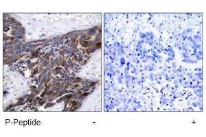 Image no. 1 for anti-Gap Junction Protein, alpha 1, 43kDa (GJA1) (pSer367), (pSer368) antibody (ABIN197018) (Connexin 43/GJA1 antibody  (pSer367, pSer368))