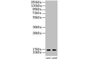 Western blot All lanes: LSM4 antibody at 2 μg/mL Lane 1: A549 whole cell lysate Lane 2: K562 whole cell lysate Secondary Goat polyclonal to rabbit IgG at 1/10000 dilution Predicted band size: 16 kDa Observed band size: 16 kDa (LSM4 antibody  (AA 1-139))