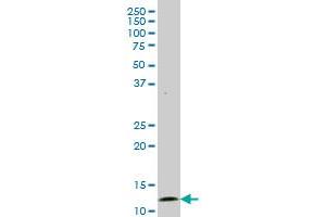 GHRL monoclonal antibody (M06), clone 4E5. (Ghrelin antibody  (AA 1-117))