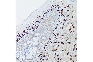 Immunohistochemistry of paraffin-embedded human tonsil using p63 Rabbit mAb (ABIN7271099) at dilution of 1:100 (40x lens). (p63 antibody)
