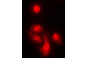Immunofluorescent analysis of KIF4A staining in MCF7 cells. (KIF4A antibody  (C-Term))