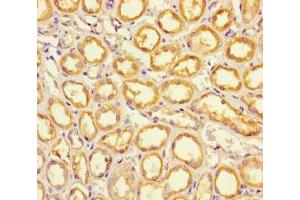 Immunohistochemistry of paraffin-embedded human kidney tissue using ABIN7151886 at dilution of 1:100 (EPS8-Like 2 antibody  (AA 201-500))