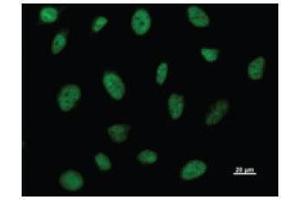 Immunostaining analysis in HeLa cells. (BRD3 antibody)