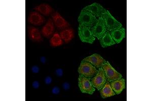 ABIN6257373 and ABIN6274770 staining HepG2 cells by IF/ICC. (RPL17 antibody  (C-Term))