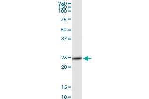 Immunoprecipitation of C9orf95 transfected lysate using anti-C9orf95 MaxPab rabbit polyclonal antibody and Protein A Magnetic Bead , and immunoblotted with C9orf95 purified MaxPab mouse polyclonal antibody (B01P) . (NMRK1 antibody  (AA 1-199))