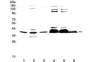 Western blot testing of 1) rat brain, 2) rat testis, 3) mouse brain, 4) human 293T, 5) human 293T and 6) human HepG2 lysate at 0. (MSI1 antibody  (AA 21-54))