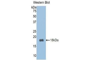 Detection of Recombinant TCF20, Mouse using Polyclonal Antibody to Transcription factor 20 (TCF20) (TCF20 antibody  (AA 392-524))