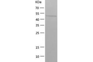 Western Blotting (WB) image for Septin 6 (SEPT6) (AA 1-434) protein (His tag) (ABIN7287174) (Septin 6 Protein (SEPT6) (AA 1-434) (His tag))