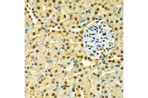 Immunohistochemistry (IHC) image for anti-Heterogeneous Nuclear Ribonucleoprotein A2/B1 (HNRNPA2B1) (AA 1-180) antibody (ABIN3021593)