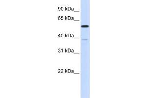 WB Suggested Anti-PPP2R5A Antibody Titration: 0. (PPP2R5A antibody  (N-Term))