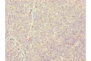 Immunohistochemistry of paraffin-embedded human tonsil tissue using ABIN7147360 at dilution of 1:100 (CENPH antibody  (AA 1-247))