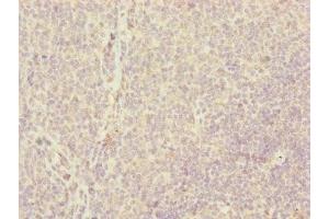 Immunohistochemistry of paraffin-embedded human tonsil tissue using ABIN7147360 at dilution of 1:100 (CENPH antibody  (AA 1-247))
