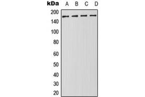 Western blot analysis of DROSHA expression in Jurkat (A), HeLa (B), NIH3T3 (C), PC12 (D) whole cell lysates.