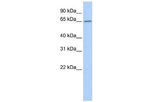 ACOT12 antibody used at 1 ug/ml to detect target protein.