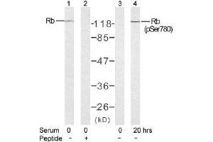 Image no. 2 for anti-Retinoblastoma 1 (RB1) (pSer780) antibody (ABIN196843) (Retinoblastoma 1 antibody  (pSer780))