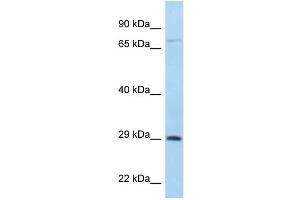 WB Suggested Anti-F11R Antibody Titration: 1.