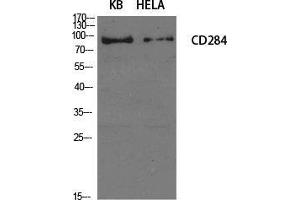 Western Blot (WB) analysis of specific cells using CD284 Polyclonal Antibody. (TLR4 antibody  (Internal Region))