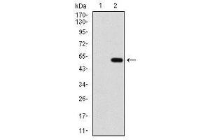 Image no. 1 for anti-Protein Phosphatase, Mg2+/Mn2+ Dependent, 1A (PPM1A) antibody (ABIN1491178) (PPM1A antibody)