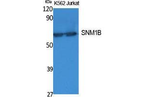 Western Blotting (WB) image for anti-DNA Cross-Link Repair 1B (DCLRE1B) (C-Term) antibody (ABIN3187627) (DCLRE1B antibody  (C-Term))