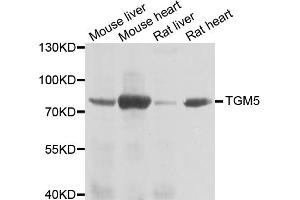 Western blot analysis of extracts of various cell lines, using TGM5 antibody. (Transglutaminase 5 antibody)