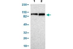 Western Blot analysis of (1) human cell line RT-4, and (2) human cell line U-251MG sp. (KIF2A antibody  (AA 35-144))