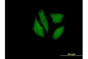 Immunofluorescence of purified MaxPab antibody to MGC5987 on HeLa cell. (MDP1 antibody  (AA 1-176))