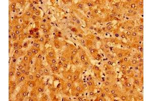 Immunohistochemistry of paraffin-embedded human liver tissue using ABIN7158957 at dilution of 1:100 (MCAT antibody  (AA 22-117))