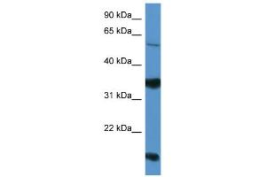 WB Suggested Anti-NTNG2 Antibody Titration: 0. (Netrin G2 antibody  (Middle Region))