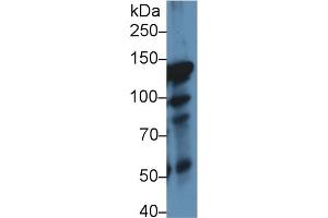 Detection of ITIH4 in Rat Lung lysate using Polyclonal Antibody to Inter Alpha-Globulin Inhibitor H4 (ITIH4) (ITIH4 antibody  (AA 478-722))