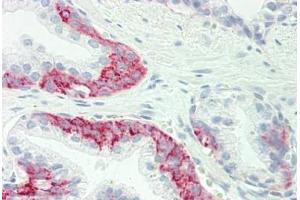 Human Prostate: Formalin-Fixed, Paraffin-Embedded (FFPE) (GJC1 antibody  (Asn361))