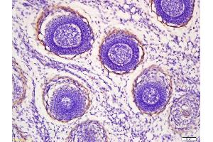 Formalin-fixed and paraffin embedded mouse embryo labeled with Anti-Myosin heavy chain 1 Polyclonal Antibody, Unconjugated (ABIN759326) at 1:200 followed by conjugation to the secondary antibody and DAB staining (MYH1 antibody  (AA 901-1000))