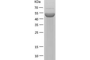 UBA3 Protein (AA 1-463) (His tag)