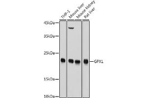 Western blot analysis of extracts of various cell lines, using GPX1 antibody (ABIN3021455, ABIN3021456, ABIN3021457, ABIN1512957 and ABIN6215063) at 1:1000 dilution. (Glutathione Peroxidase 1 antibody  (AA 50-203))