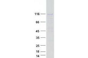 Western Blotting (WB) image for SAPS Domain Family, Member 2 (SAPS2) protein (Myc-DYKDDDDK Tag) (ABIN2731394)