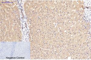 Immunohistochemical analysis of paraffin-embedded human liver tissue.