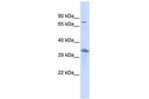 Image no. 1 for anti-Thyrotrophic Embryonic Factor (TEF) (AA 431-480) antibody (ABIN6742378)