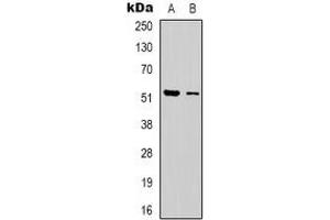 Western blot analysis of Dematin expression in Jurkat (A), HEK293T (B) whole cell lysates. (Dematin antibody  (C-Term))