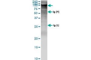 Immunoprecipitation of ZFYVE9 transfected lysate using anti-ZFYVE9 MaxPab rabbit polyclonal antibody and Protein A Magnetic Bead , and immunoblotted with ZFYVE9 MaxPab rabbit polyclonal antibody (D01) . (ZFYVE9 antibody  (AA 1-762))