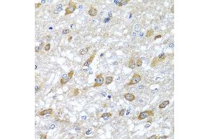 Immunohistochemistry of paraffin-embedded rat brain using HSPA6 antibody at dilution of 1:100 (x40 lens).
