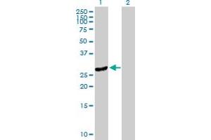Western Blot analysis of DNAJC27 expression in transfected 293T cell line by DNAJC27 MaxPab polyclonal antibody. (DNAJC27 antibody  (AA 1-273))