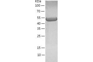 Western Blotting (WB) image for Guanine Deaminase (GDA) (AA 1-454) protein (His tag) (ABIN7289207) (GDA Protein (AA 1-454) (His tag))