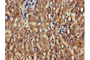 Immunohistochemistry of paraffin-embedded human liver tissue using ABIN7147124 at dilution of 1:100 (CD166 antibody  (AA 28-516))