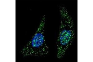 Fluorescent image of U251 cells stained with ATG5 antibody at 1:200. (ATG5 antibody  (AA 1-30))