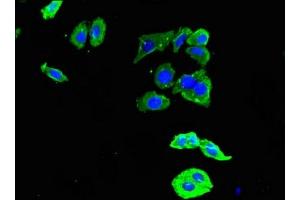 Immunofluorescent analysis of HepG2 cells using ABIN7150025 at dilution of 1:100 and Alexa Fluor 488-congugated AffiniPure Goat Anti-Rabbit IgG(H+L) (DDR2 antibody  (AA 447-540))