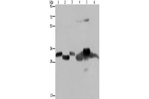 Western Blotting (WB) image for anti-3-Hydroxymethyl-3-Methylglutaryl-CoA Lyase (HMGCL) antibody (ABIN2430230) (HMGCL antibody)