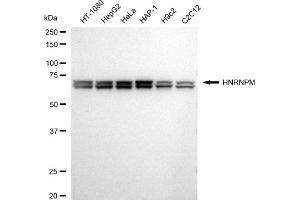 anti-Heterogeneous Nuclear Ribonucleoprotein M (HNRNPM) antibody