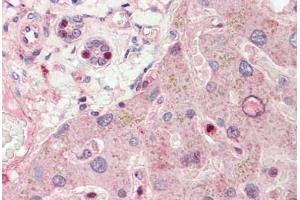 Human Liver: Formalin-Fixed, Paraffin-Embedded (FFPE) (RALGPS1 antibody  (AA 326-375))