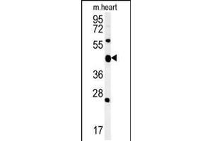 Western blot analysis in mouse heart tissue lysates (15ug/lane). (ACSF3 antibody  (AA 413-442))