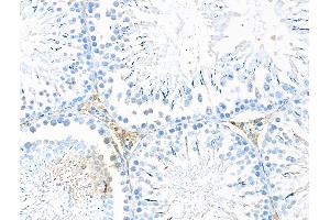 ABIN7094554 and ABIN7098603 at 1/100 staining Rat testis tissue by IHC-P.
